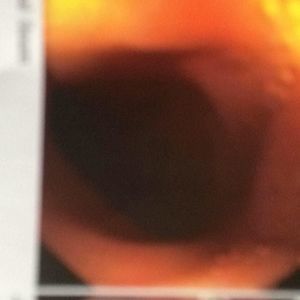 Meet your Posher, Darin